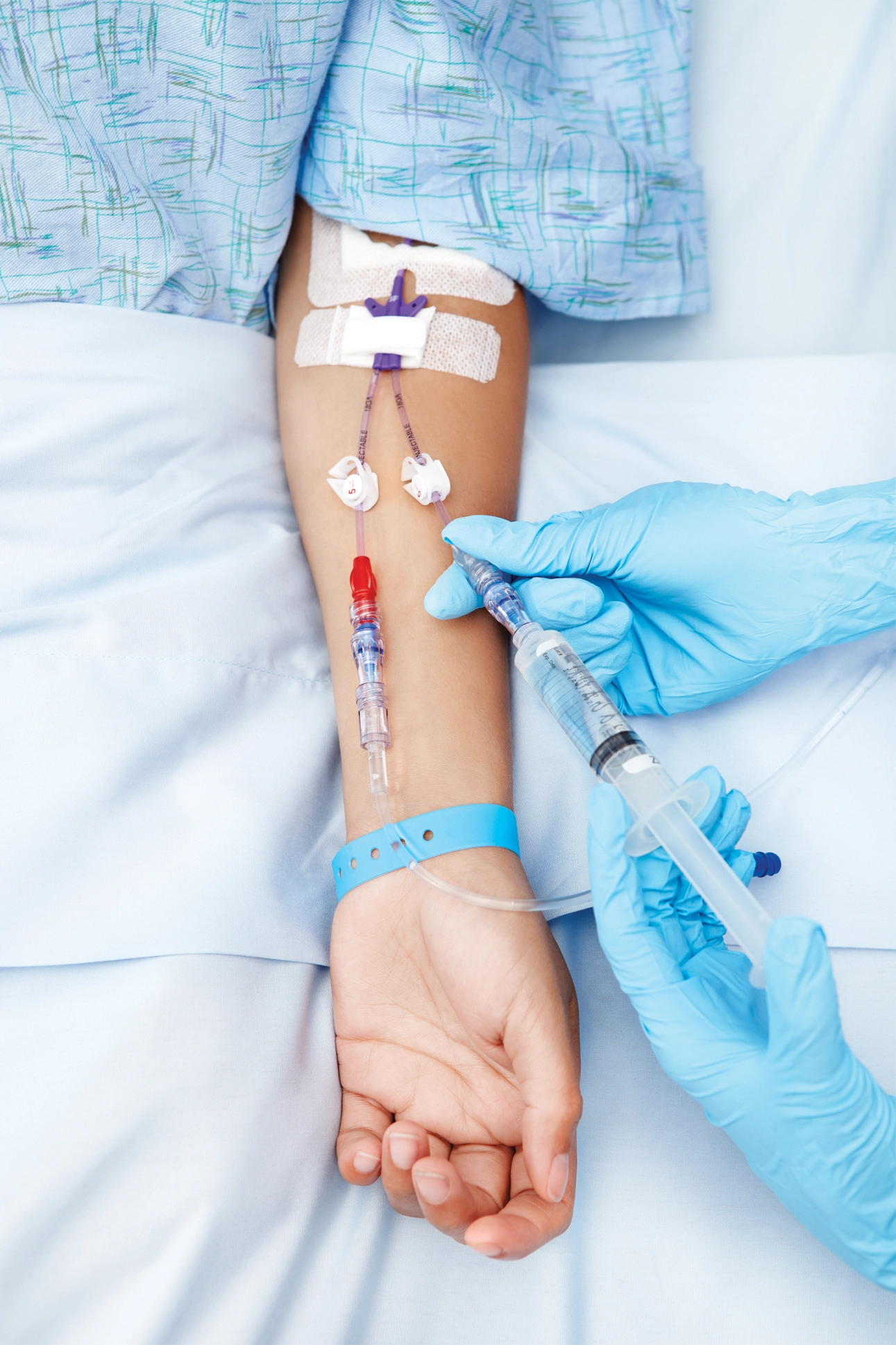 Intravenous (IV) Therapy