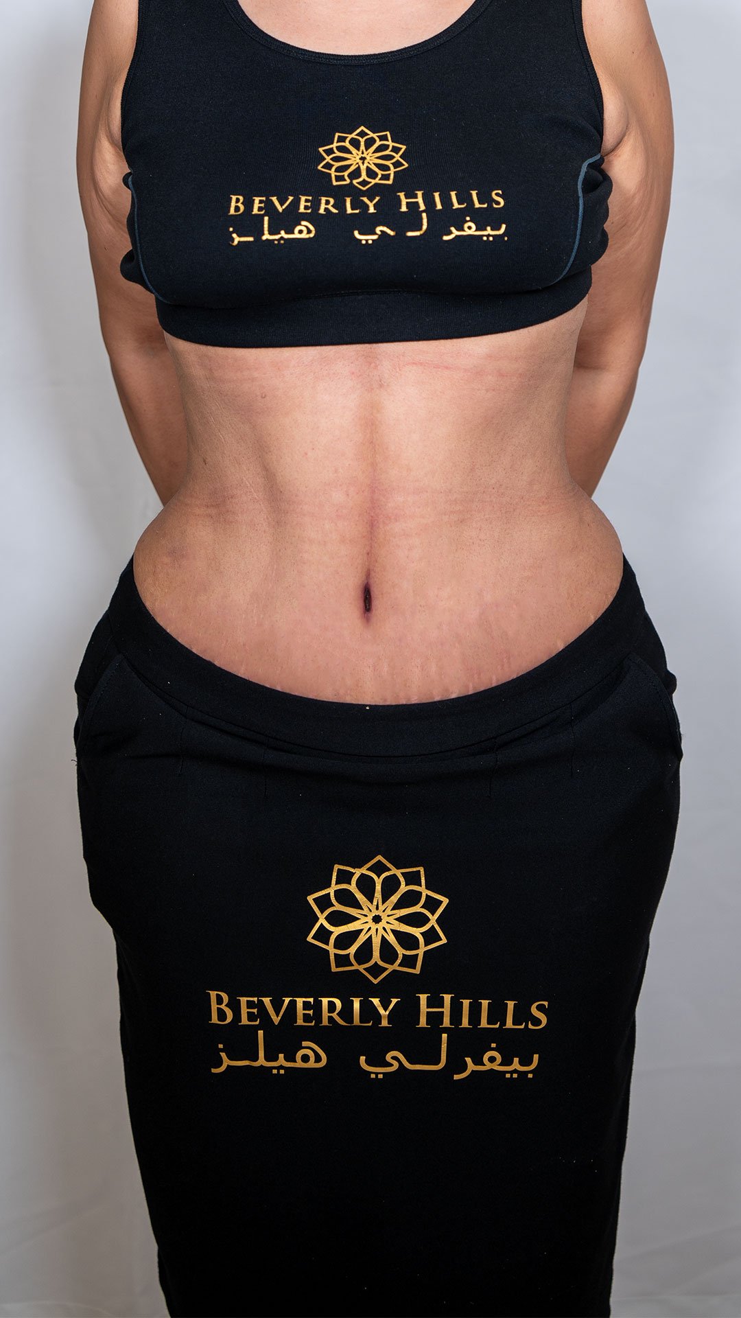 Tummy Tuck Surgery